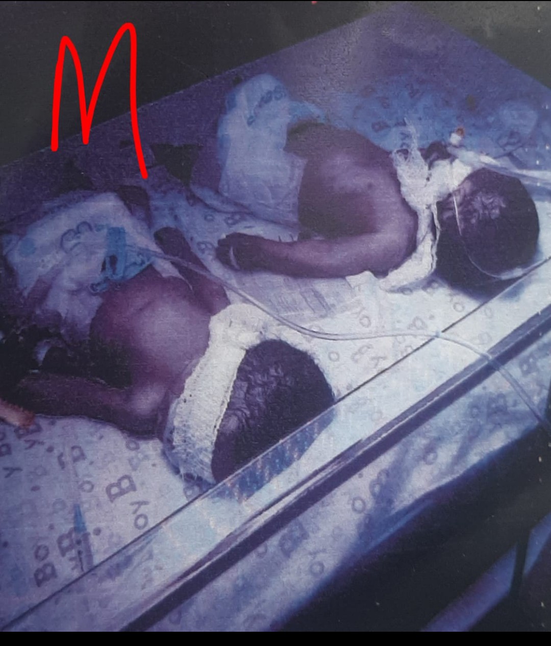 Twin Tragedy: Edo Hospital Under Fire Over Babies’ Death